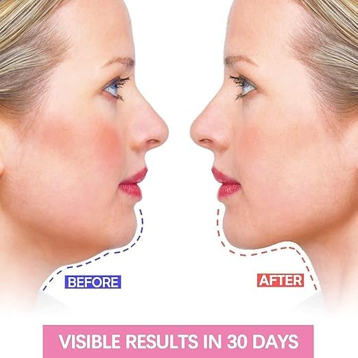 Double Chin Reducer & Face Tightening Mask V-Line Beauty Strap for Women – Use While Sleeping (Set of 2)