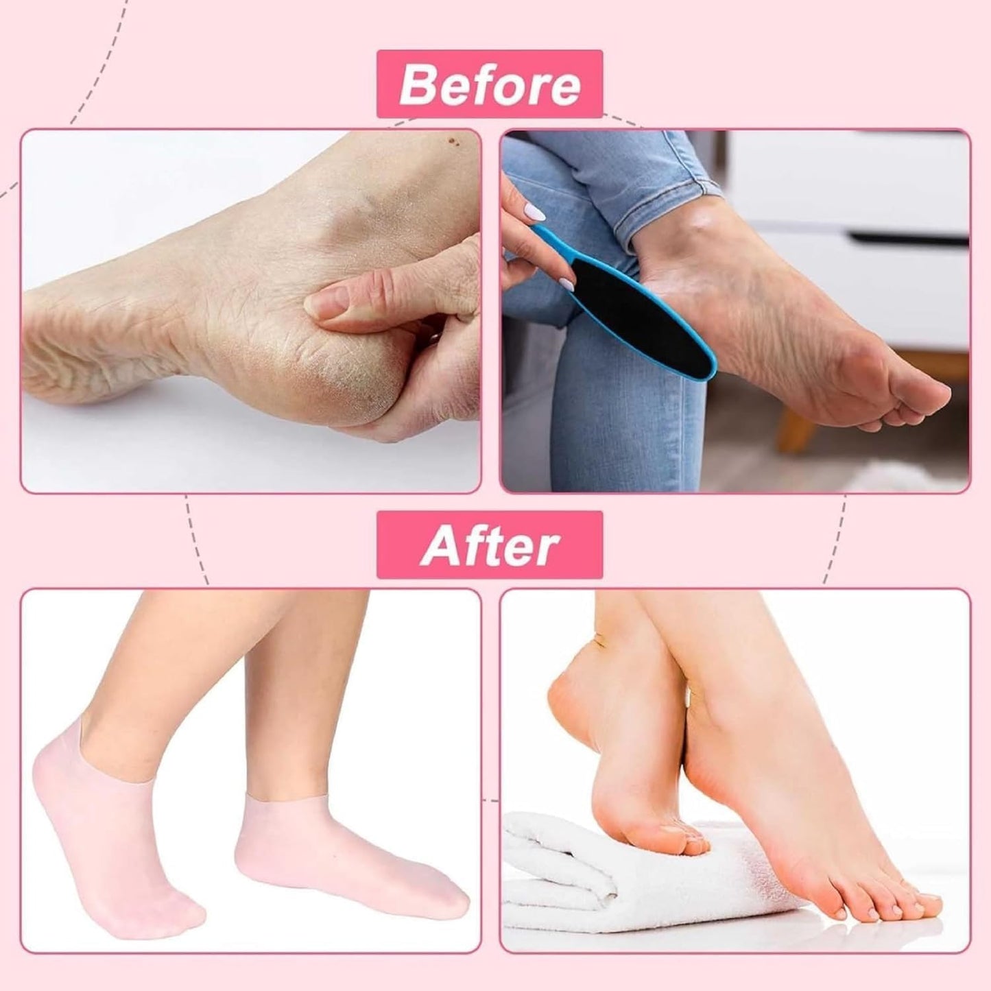 Moisturizing Gel Heel Socks for Cracked Feet – Silicone Spa Socks with Natural Oils & Vitamin E for Women & Men – 2 Pair (Multicolor)