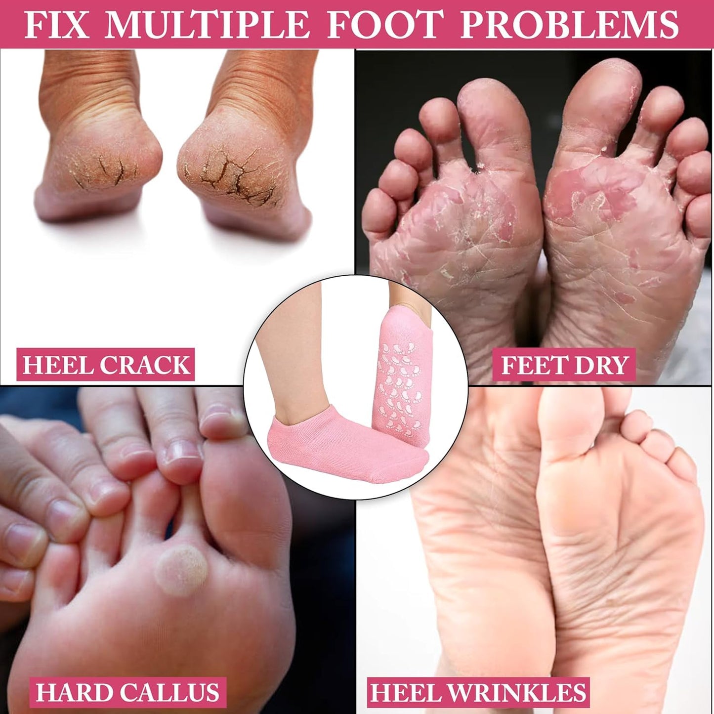 Moisturizing Gel Heel Socks for Cracked Feet – Silicone Spa Socks with Natural Oils & Vitamin E for Women & Men – 2 Pair (Multicolor)